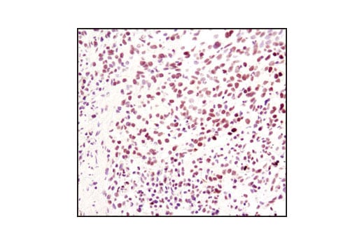 Immunohistochemistry Image 2: Di-Methyl-Histone H3 (Lys4) (C64G9) Rabbit mAb (BSA and Azide Free)