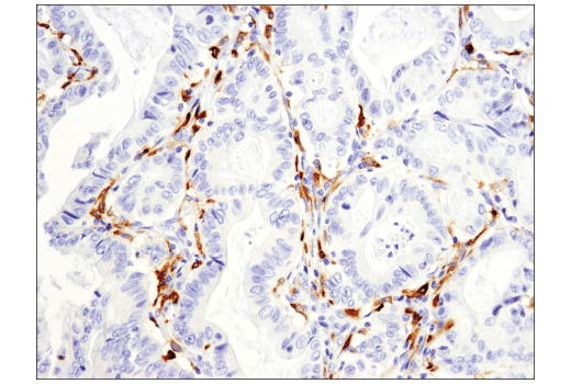 Immunohistochemistry Image 1: CD163 (D6U1J) Rabbit mAb