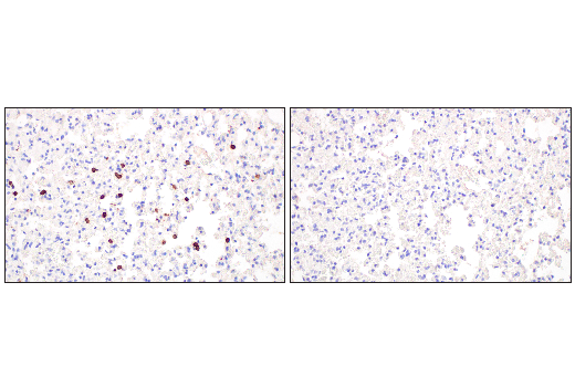 Immunohistochemistry Image 3: CD20 (E3N7O) XP<sup>®</sup> Rabbit mAb (BSA and Azide Free)