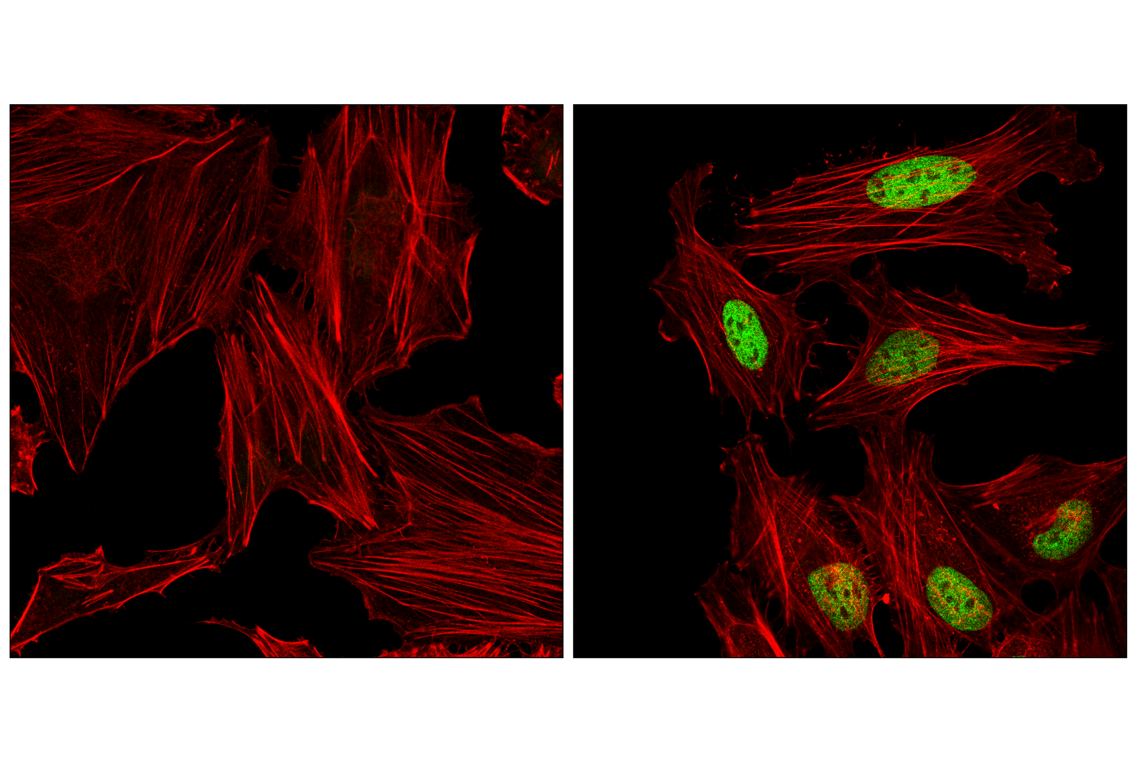 Immunofluorescence Image 1: ATF-4 (E4Q4E) Mouse mAb
