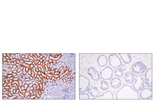 Immunohistochemistry Image 5: AQP4 (D1F8E) XP<sup>®</sup> Rabbit mAb