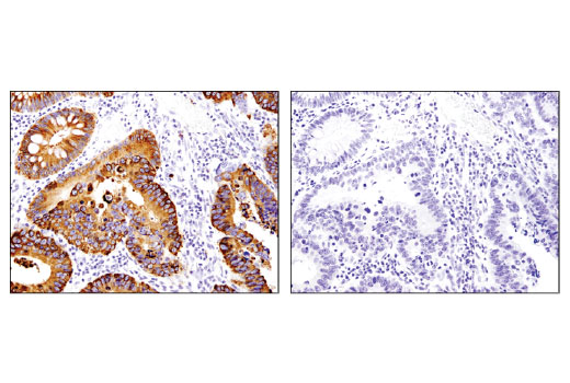 Immunohistochemistry Image 4: OLFM4 (D1E4M) XP<sup>®</sup> Rabbit mAb
