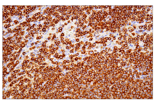 Immunohistochemistry Image 6: CD20 (L26) Mouse mAb