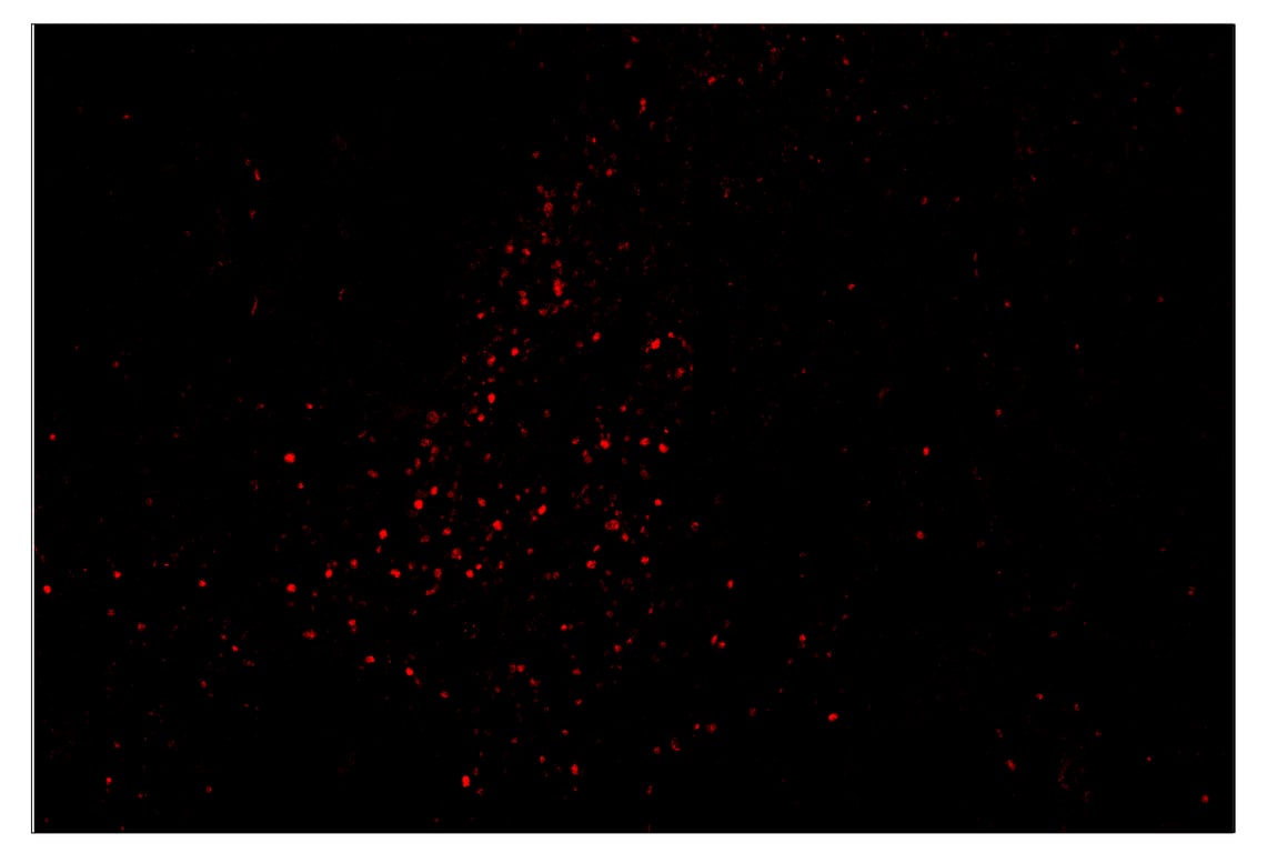 Immunohistochemistry Image 4: Tox/Tox2 (E6I3Q) & CO-0016-750 SignalStar<sup>™</sup> Oligo-Antibody Pair