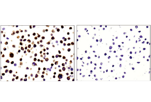 Immunohistochemistry Image 4: PKCθ (E1I7Y) Rabbit mAb (BSA and Azide Free)