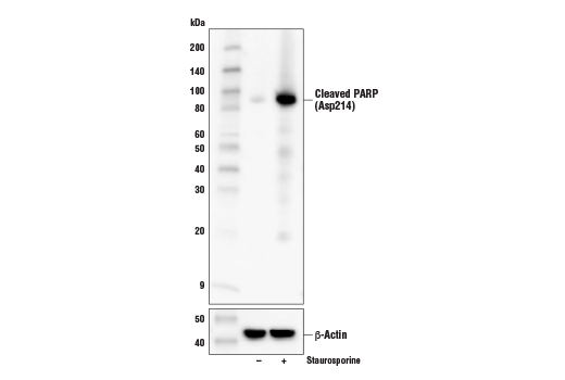 undefined Image 8: Tau Mouse Model Neuronal Viability IF Antibody Sampler Kit