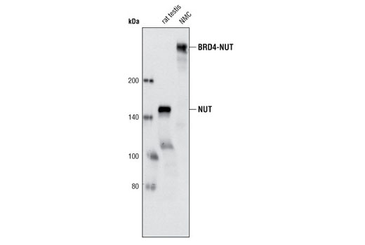 Western Blotting Image 1: NUT (C52B1) Rabbit mAb (BSA and Azide Free)