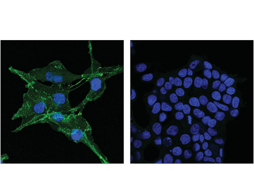 Immunofluorescence Image 1: N-Cadherin (D4R1H) XP<sup>®</sup> Rabbit mAb (Alexa Fluor<sup>®</sup> 488 Conjugate)