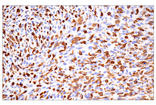 Immunohistochemistry Image 12: p22phox (E7Y1F) XP<sup>®</sup> Rabbit mAb