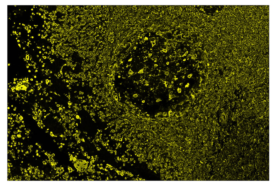 Immunohistochemistry Image 3: Vimentin (D21H3) & CO-0012-647 SignalStar<sup>™</sup> Oligo-Antibody Pair