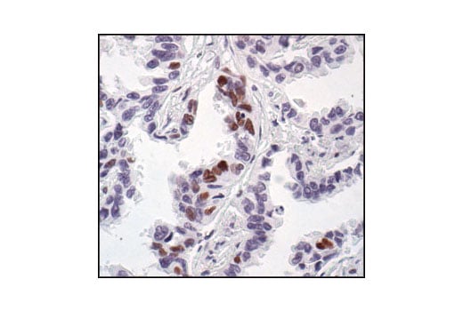 undefined Image 5: PhosphoPlus<sup>®</sup> CREB (Ser133) Antibody Duet