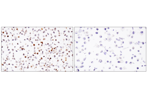 Immunohistochemistry Image 3: BCL6 (E5I8I) Rabbit mAb (BSA and Azide Free)
