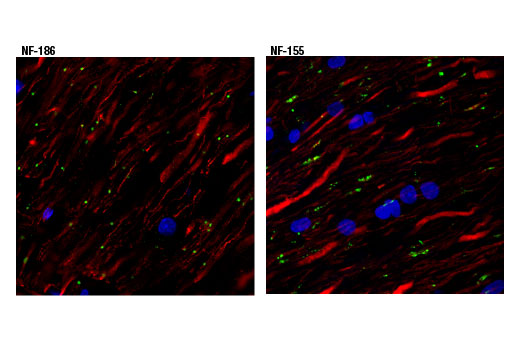 undefined Image 25: Demyelinating Disease Targets Antibody Sampler Kit