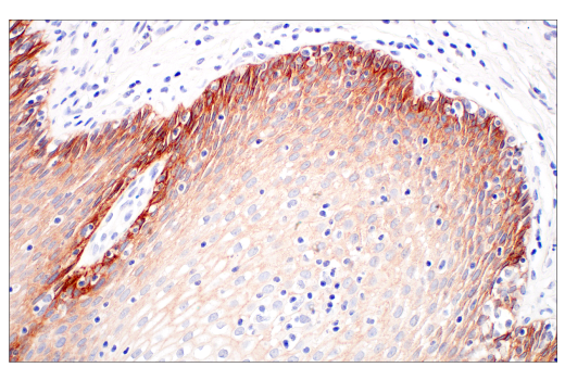 Immunohistochemistry Image 5: Integrin β6 (E4M9P) XP<sup>®</sup> Rabbit mAb