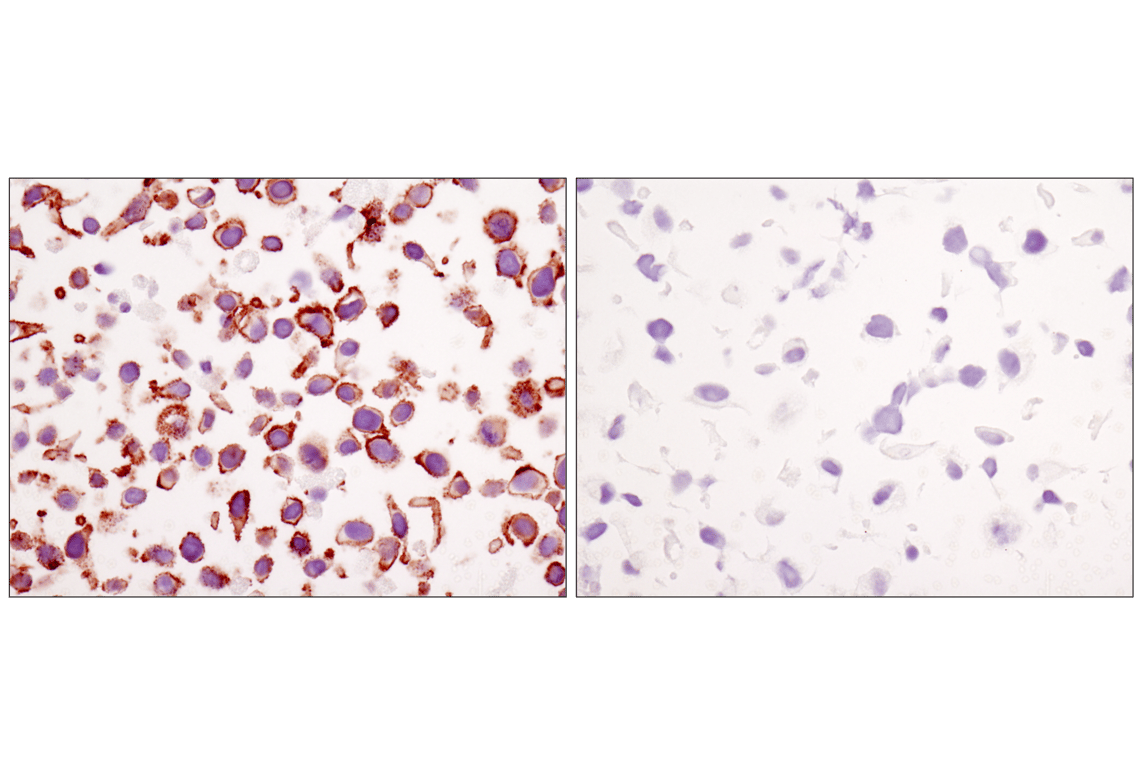 Immunohistochemistry Image 5: β-Catenin (D10A8) XP<sup>®</sup> Rabbit mAb (BSA and Azide Free)