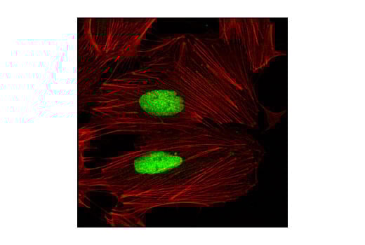 undefined Image 24: Microglia Proliferation Module Antibody Sampler Kit