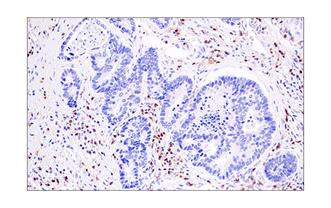 Immunohistochemistry Image 2: LAT (E3U6J) XP<sup>®</sup> Rabbit mAb (BSA and Azide Free)