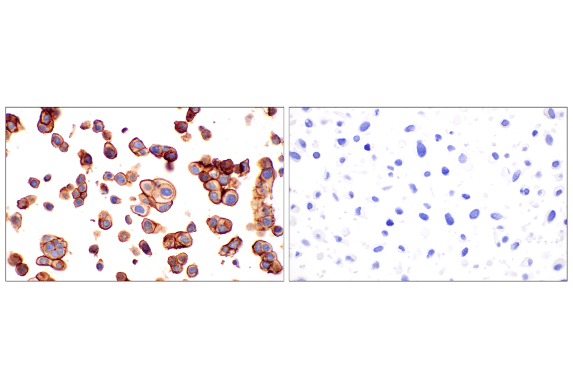 Immunohistochemistry Image 12: TACSTD2/TROP2 (F4W4J) Rabbit mAb (BSA and Azide Free)