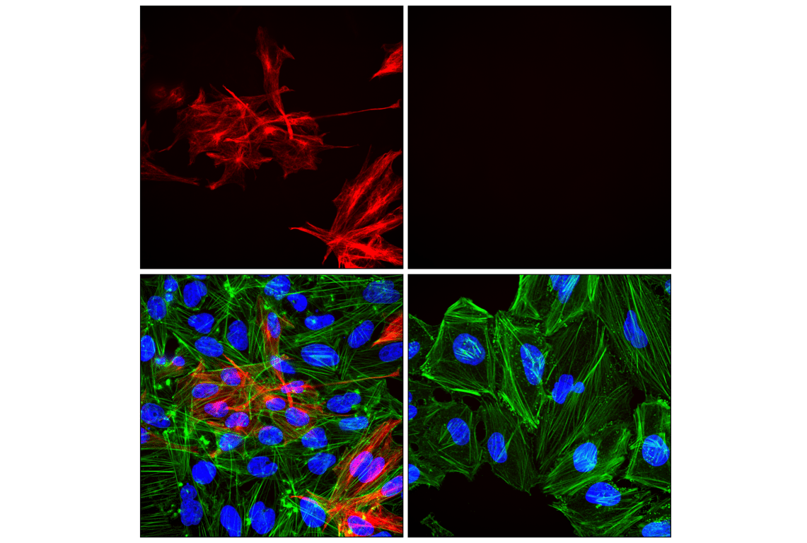 Immunofluorescence Image 1: GFAP (E4L7M) XP<sup>®</sup> Rabbit mAb (Alexa Fluor<sup>®</sup> 647 Conjugate)