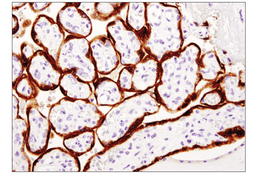 Immunohistochemistry Image 2: Aromatase (D5Q2Y) Rabbit mAb