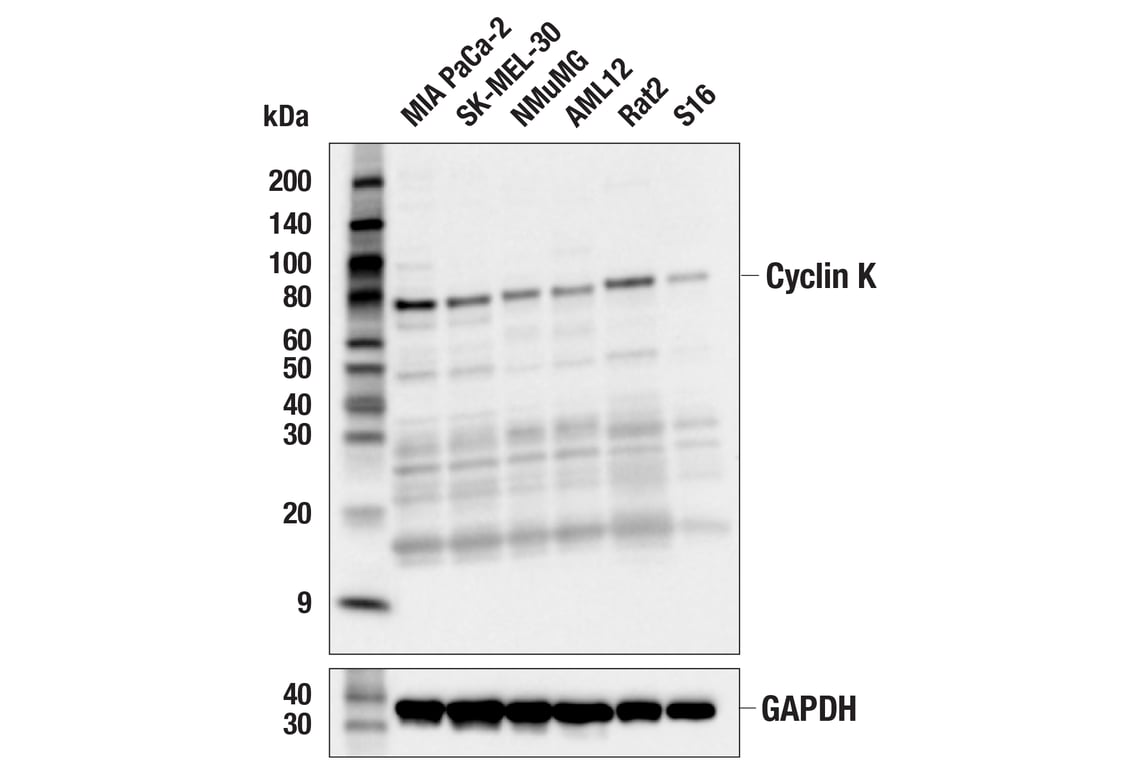 Western Blotting Image 3: Cyclin K (E7F4N) Rabbit mAb