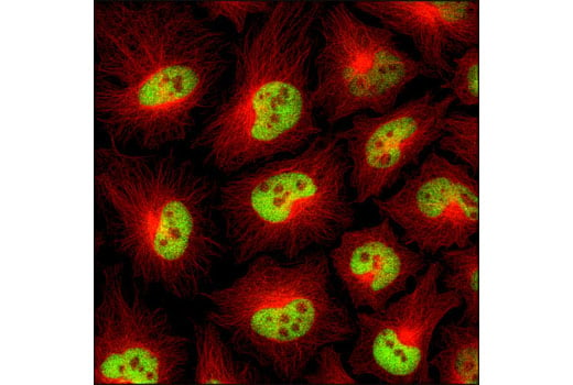 undefined Image 7: PhosphoPlus<sup>®</sup> Histone H3 (Ser10) Antibody Duet