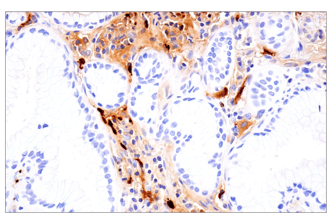 Immunohistochemistry Image 4: S100A8 (F4R2W) Rabbit mAb (BSA and Azide Free)