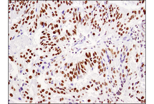 undefined Image 46: BAF Complex IHC Antibody Sampler Kit