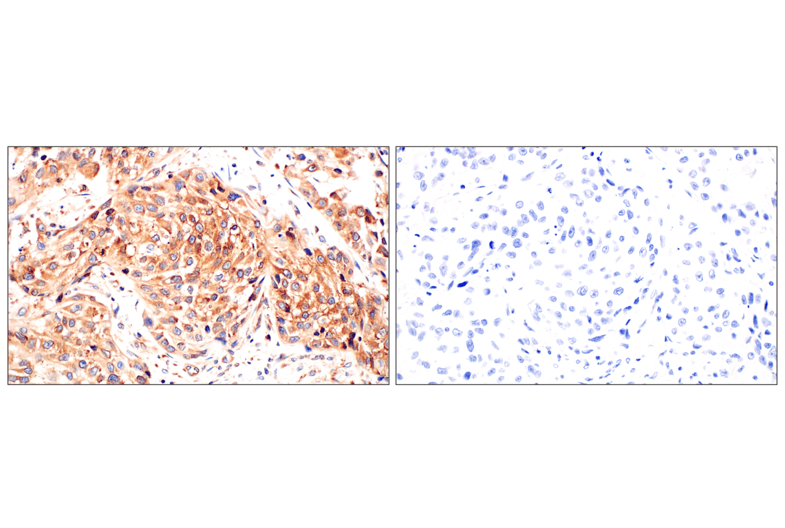 Immunohistochemistry Image 11: RACK1 (D59D5) Rabbit mAb