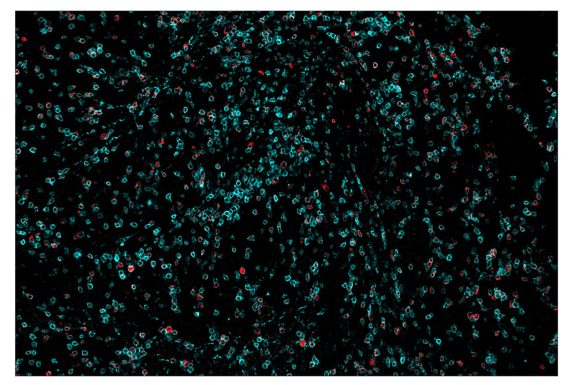 Immunohistochemistry Image 1: LAG3 (D2G4O<sup>™</sup>) & CO-0026-647 SignalStar<sup>™</sup> Oligo-Antibody Pair