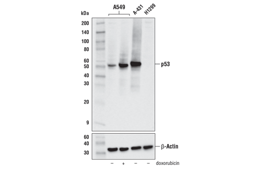 Western Blotting Image 1: p53 (DO-1) Mouse mAb
