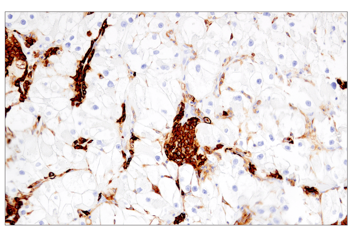 Immunohistochemistry Image 4: CD38 (E7Z8C) XP<sup>®</sup> Rabbit mAb (BSA and Azide Free)