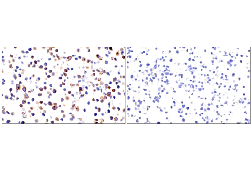 Immunohistochemistry Image 6: CD7 (LP15) Mouse mAb