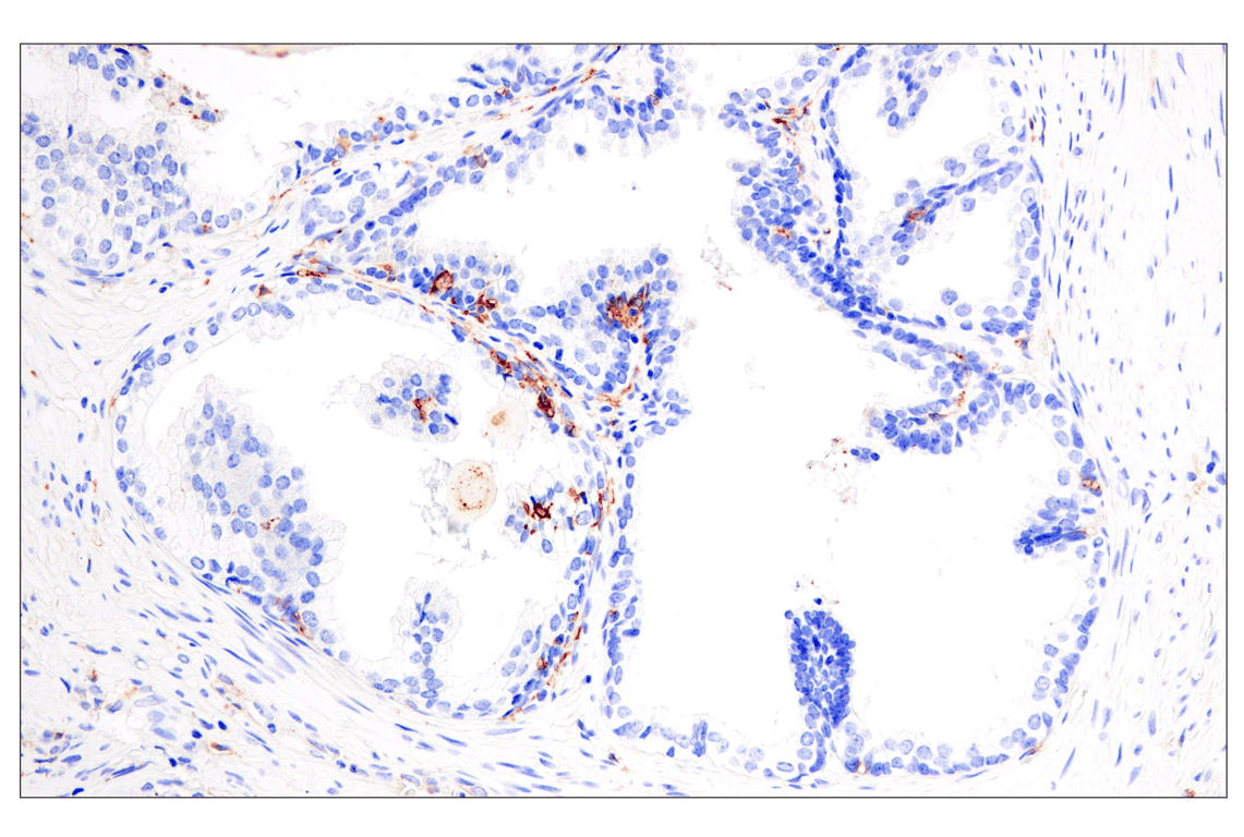 Immunohistochemistry Image 2: HLA-DRA (E9R2Q) XP<sup>®</sup> Rabbit mAb