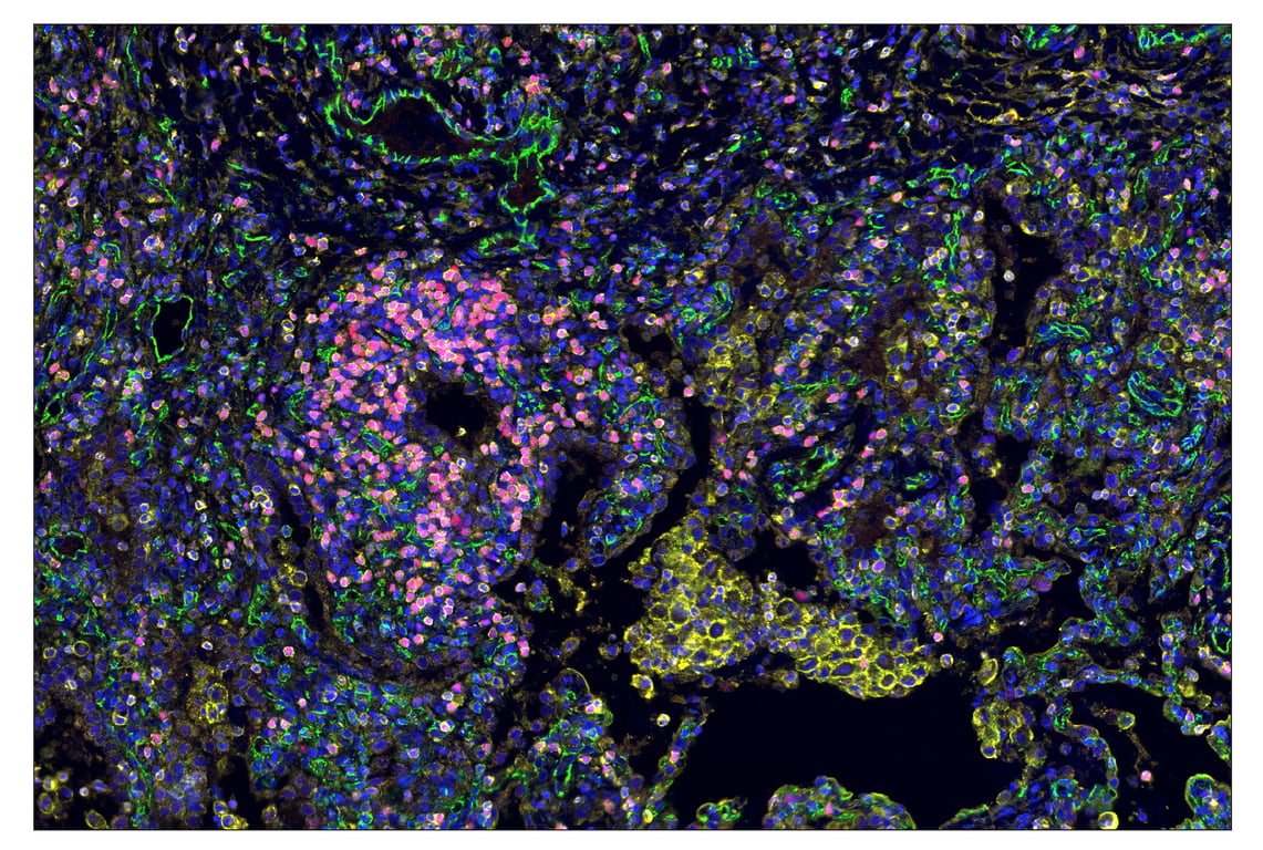 Immunohistochemistry Image 1: TIM-3 (D5D5R<sup>™</sup>) & CO-0010-594 SignalStar<sup>™</sup> Oligo-Antibody Pair