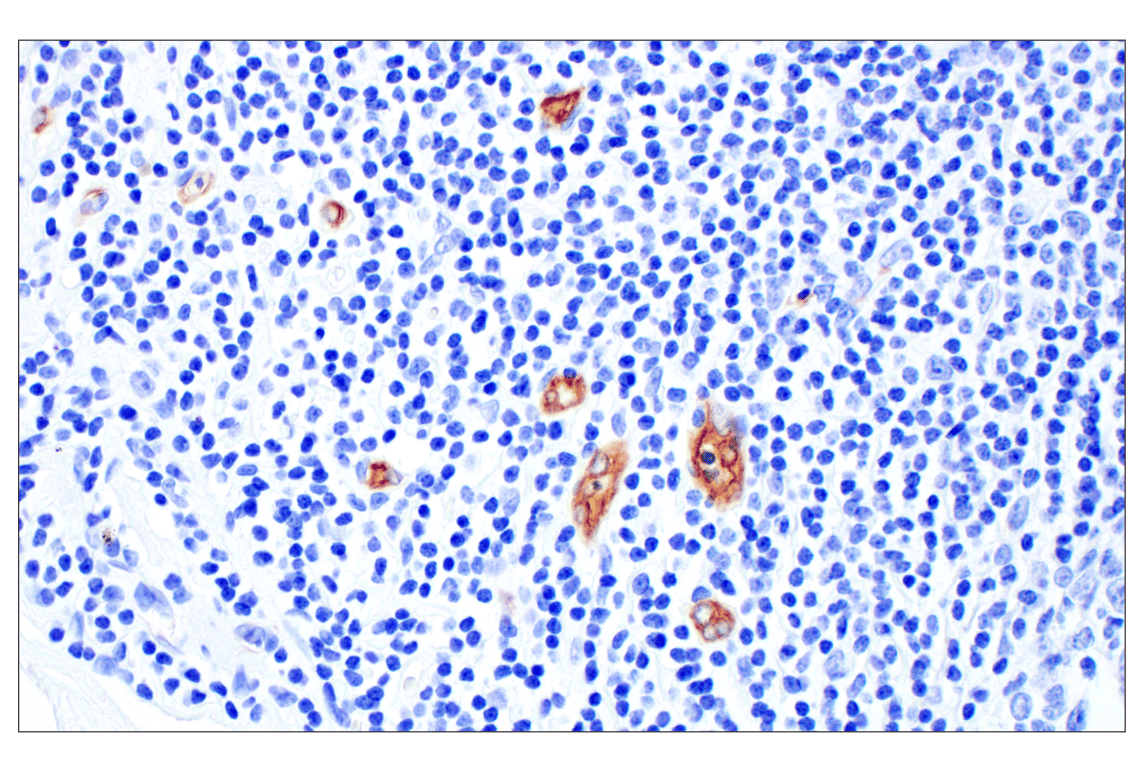 Immunohistochemistry Image 5: MAdCAM-1 (E1V8F) Rabbit mAb