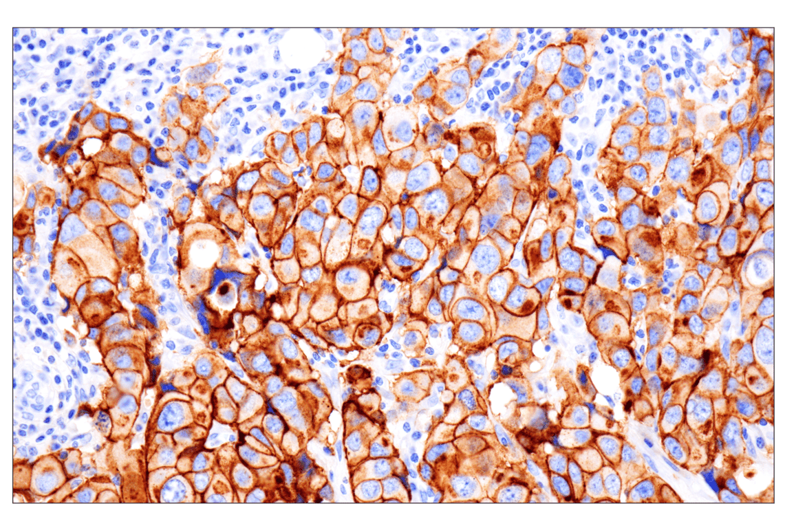 Immunohistochemistry Image 2: FGF Receptor 2 (D4L2V) Rabbit mAb (BSA and Azide Free)