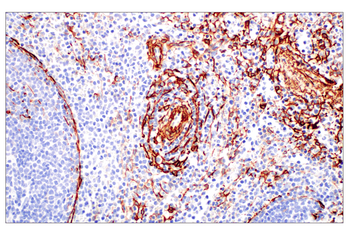 Immunohistochemistry Image 9: α-Smooth Muscle Actin (D4K9N) XP<sup>®</sup> Rabbit mAb (BSA and Azide Free)