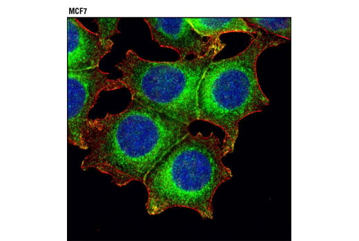 Immunofluorescence Image 1: Rab8A (D22D8) XP<sup>®</sup> Rabbit mAb