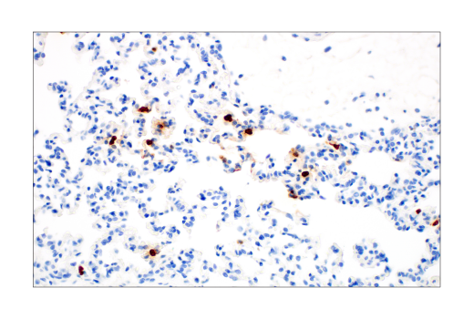 Immunohistochemistry Image 5: S100A9 (D3U8M) Rabbit mAb