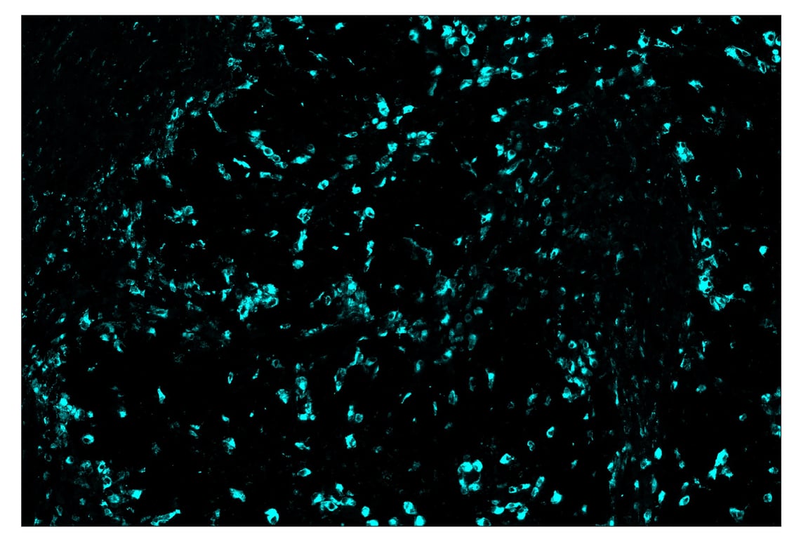 Immunohistochemistry Image 5: CD68 (D4B9C) & CO-0007-594 SignalStar<sup>™</sup> Oligo-Antibody Pair