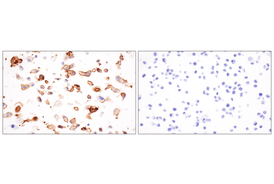 Immunohistochemistry Image 11: LRRC15 (E4X8J) Rabbit mAb