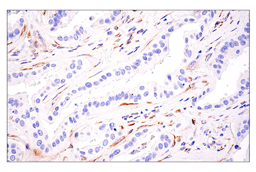 Immunohistochemistry Image 1: LOXL2 (E3P7Y) Rabbit mAb (BSA and Azide Free)