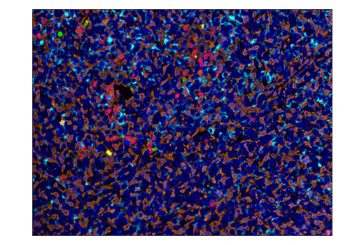 Immunohistochemistry Image 6: PD-1 (Intracellular Domain) (D7D5W) XP<sup>®</sup> Rabbit mAb