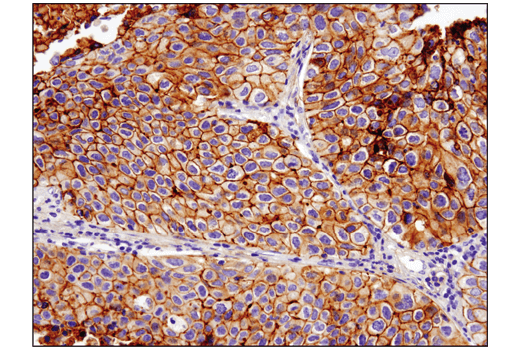 Immunohistochemistry Image 1: B7-H3 (D9M2L) XP<sup>®</sup> Rabbit mAb (BSA and Azide Free)