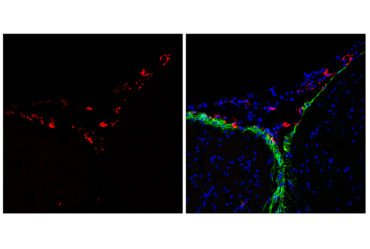 Immunofluorescence Image 1: p22phox (E7Y1F) XP<sup>®</sup> Rabbit mAb