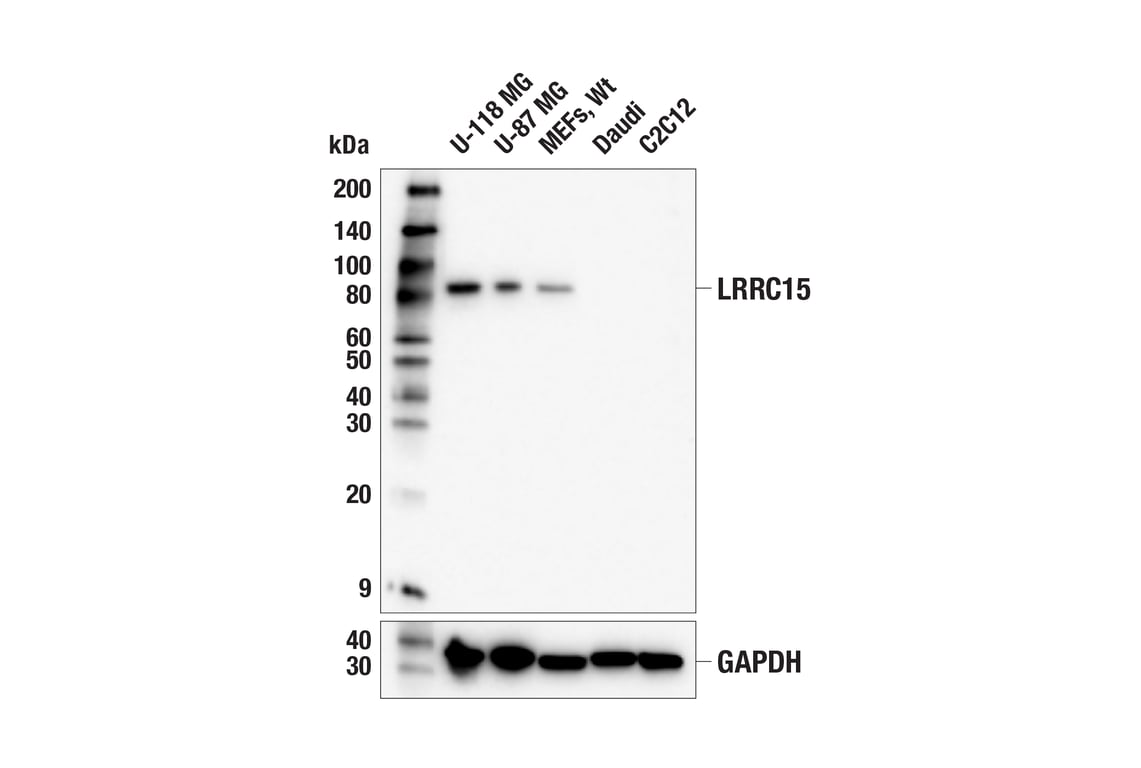 Western Blotting Image 1: LRRC15 (E4X8J) Rabbit mAb