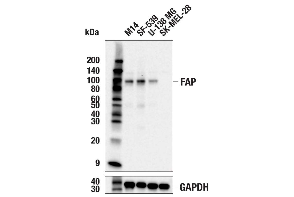 Western Blotting Image 1: FAP (F1A4G) Rabbit mAb (BSA and Azide Free)