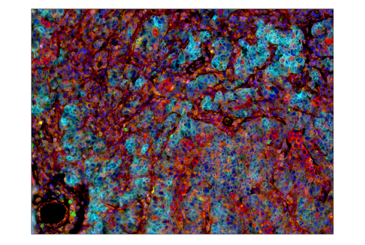 Immunohistochemistry Image 4: B7-H3 (D9M2L) XP<sup>®</sup> Rabbit mAb (BSA and Azide Free)