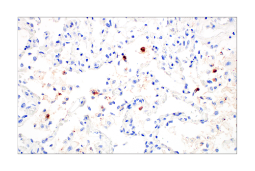 Immunohistochemistry Image 1: SARS-CoV-2 Nucleocapsid Protein (HL344) Rabbit mAb
